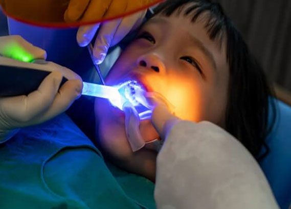 Young child receiving dental examination with blue LED light in dental office setting.