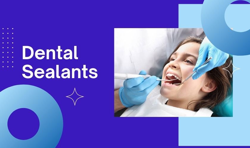 Dental Sealants