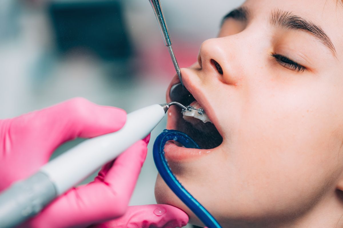 Clean Your Child’s Braces