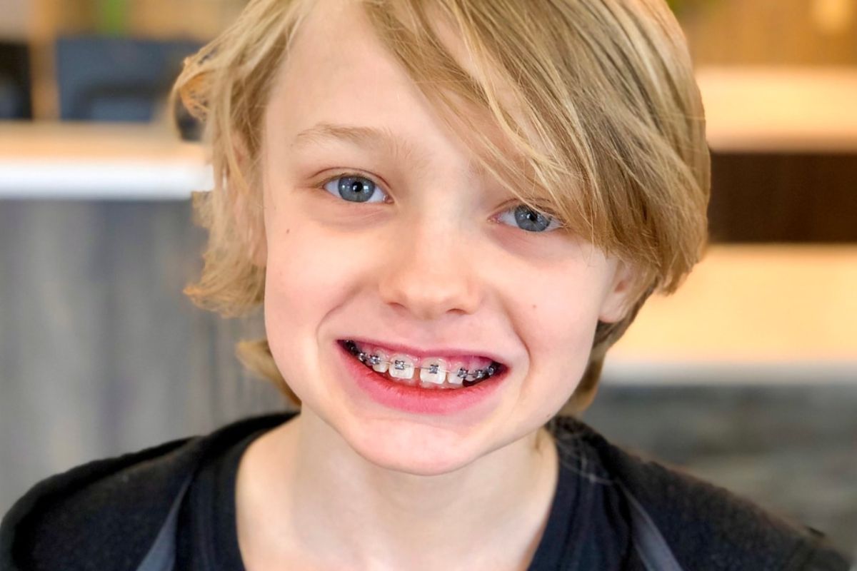 Kids' Braces | Orthodontic Treatment Wichita Falls, TX