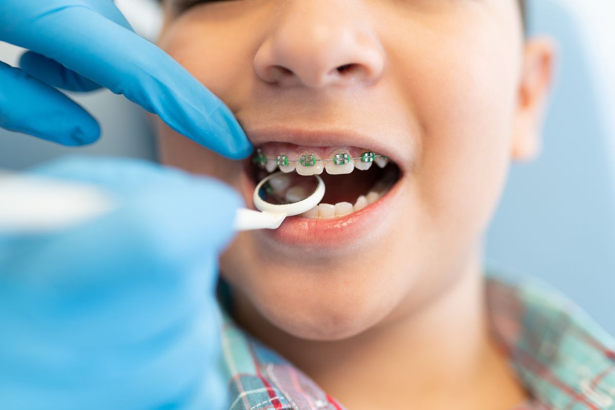 Featured image for “What Are the Signs of an Allergic Reaction to Braces Materials?”