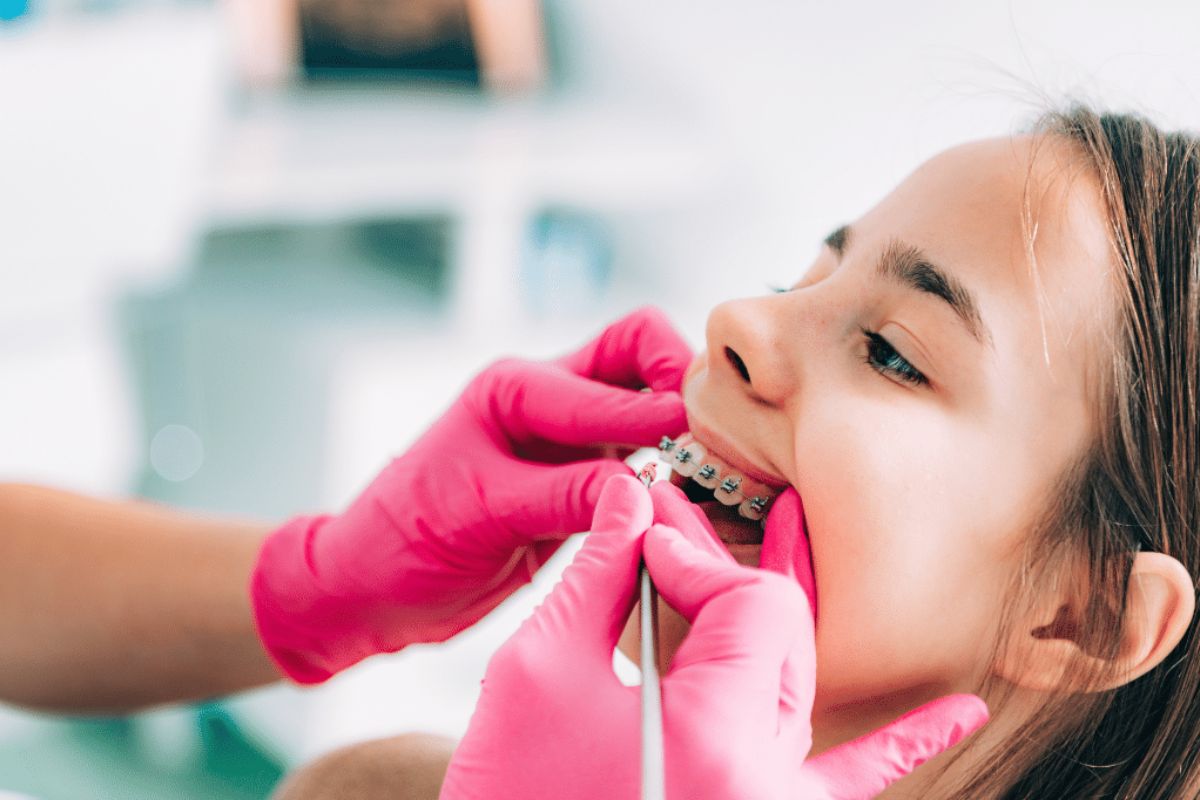 Featured image for “How Early Orthodontic Treatment Helps Kids in Wichita Falls Avoid Surgery”